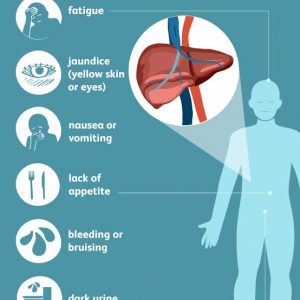 One person dies of hepatitis every 30 seconds worldwide: Experts